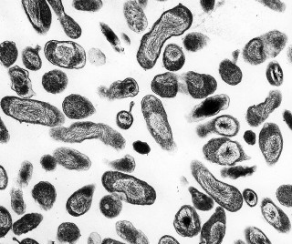 4. Coxiella burnetii, the bacteria that causes Q fever. Photo Credit: Rocky Mountain Laboratories; NIAID Biodefense Image Library (http://www.niaid.nih.gov/Biodefense/Public/Images.htm), National Institute of Allergy and Infectious Diseases (NIAID, http://www.niaid.nih.gov), National Institutes of Health (NIH, http://www.nih.gov), United States Department of Health and Human Services (http://www.dhhs.gov), Government of the United States of America (USA).