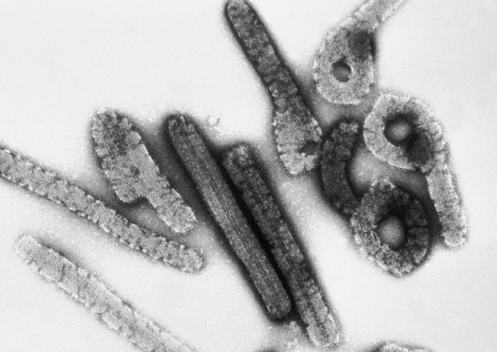 Magnified approximately 100,000 times, this negative stain image of an isolate of Marburg virus, a filovirus with membership in a family of often deadly RNA viruses called the Filoviridae, shows filamentous particles as well as the characteristic Shepherd's Crook shape. Photo Credit: Dr. Erskine Palmer and Russell Regnery, Ph.D., 1981, 'Transmission electron micrograph of Marburg virus', PHIL ID# 275, Public Health Image Library (PHIL, http://phil.cdc.gov), Centers for Disease Control and Prevention (CDC, http://www.cdc.gov), United States Department of Health and Human Services (http://www.dhhs.gov), Government of the United States of America (USA). Additional information from CDC Special Pathogens Branch: 'Filoviruses' <http://www.cdc.gov/ncidod/dvrd/spb/mnpages/dispages/filoviruses.htm> and 'Marburg Hemorrhagic Fever' <http://www.cdc.gov/ncidod/dvrd/spb/mnpages/dispages/marburg.htm>. The other deadly Filoviridae family member, Ebola Virus, is covered in ChamorroBible.org: Manguaguan na Palabran Si Yuus, Lumuh&ucirc; (April) 30, 2005 <http://ChamorroBible.org/gpw/gpw-20050430.htm>.