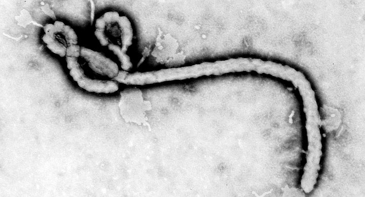 gpw-20050430a-Ebola-virus-CDC-PHIL-ID-1181.jpg